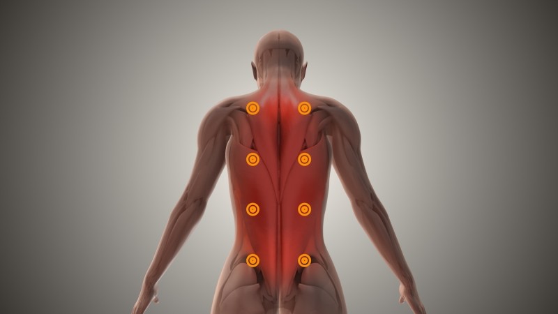 Myofasziale Therapie